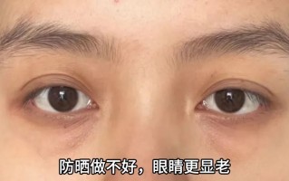 方脸什么样的眼镜好看，方脸什么样的眼镜好看图片