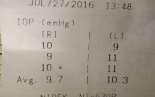 散光75的轴位一般多少，散光75度轴位是多少